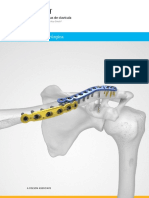 Acumed Surgical Technique ES Clavicle Acu Sinch ESSHD10 02 B PDF