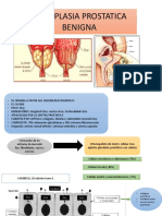 Hiperplasia Benigna Porstatica