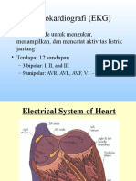 Ekg