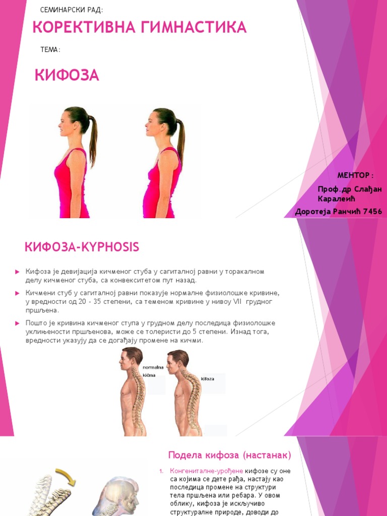КИФОЗА | PDF