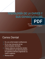 Radiología de la Caries y sus consecuencias.pdf