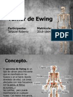 Exposición - Tumor de Ewing