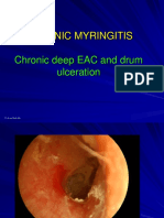 3 Chronic Myringitis
