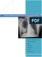 Avances Biotecnológicos en El Cancer Pulmonar - Copia