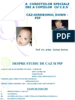 sindromul_down.ppt