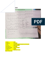 Pemeriksaan Elektrokardiografi