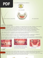 Corona Ansa y Banda Ansa | PDF | Odontología | Diente