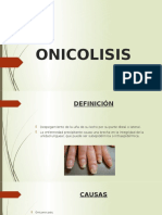 Causas y tratamiento de la onicolisis