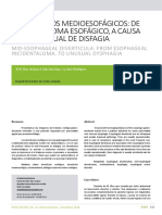 Divertículos Medioesofágicos: de Incidentaloma Esofágico, A Causa Poco Habitual de Disfagia