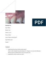 Kasus 6 Oral Melanotic Macule-Ayu