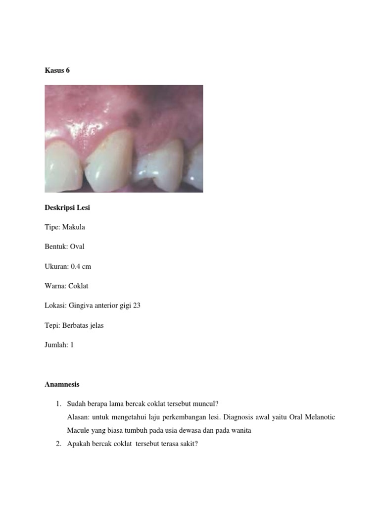sterile water for melanotan 2 Buy Melanotan 2 For Research Purposes