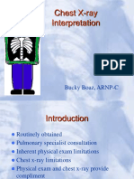 Chest X-ray Interpretation Guide