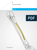 Soluciones Quirúrgicas para Fractura de Antebrazo