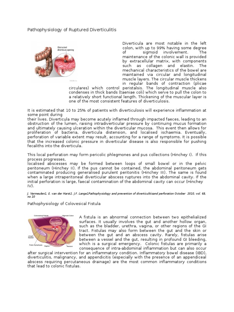 Pa Tho Physiology of Ruptured Diverticulitis | PDF | Gastrointestinal ...
