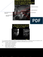 Test Resonancia Magnetica