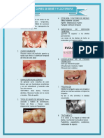 Caries de Odontopeditria