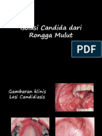 Isolasi Candida dari Rongga Mulut