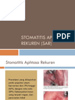 Stomatitis Aphtosa Rekuren (Sar)