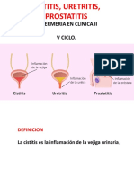 Cistitis