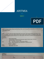 ARITMIA