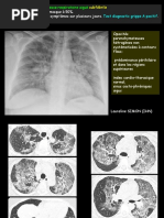 Grippe-A1-22015 1