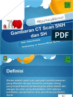 CT Scan SNH & SH
