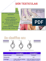 Torsión Testicular