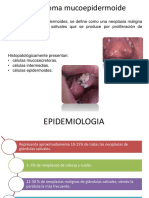 Carcinoma Mucoepidermoide