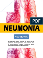 Pulmonia Meningitis