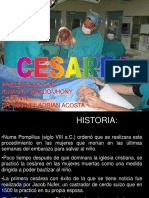 Cesarea