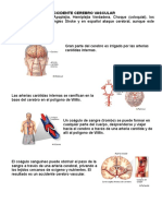 Accidente Cerebro Vascular