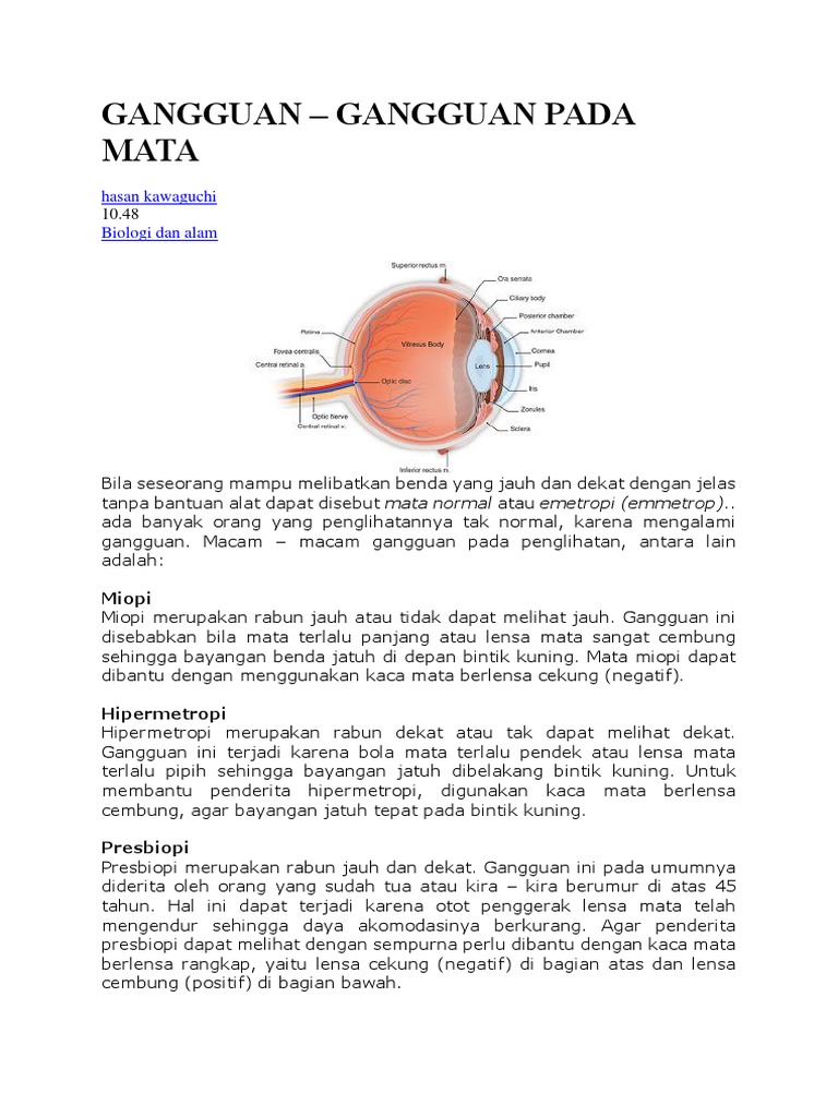 Miopi Hipermetropi Pdf