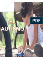 El autismo: características, tipos y tratamiento