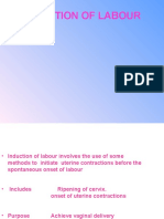 inductionoflabour