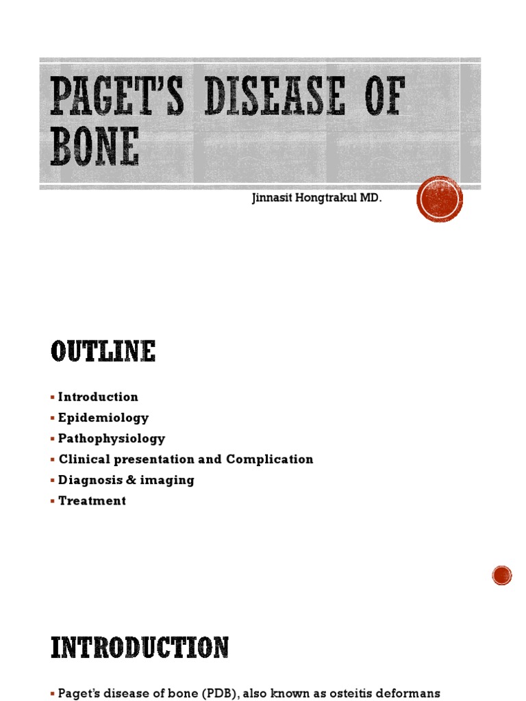 Paget's Disease of Bone PDF Bone Diseases And Disorders