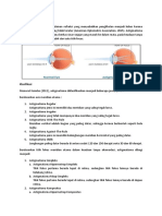 Astigmatisme + Oklusi Vena Arteri Retina