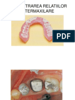 INREGISTRAREA RELATIILOR INTERMAXILARE.ppt