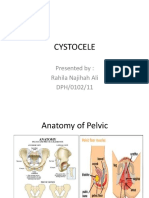 Cystocele 2