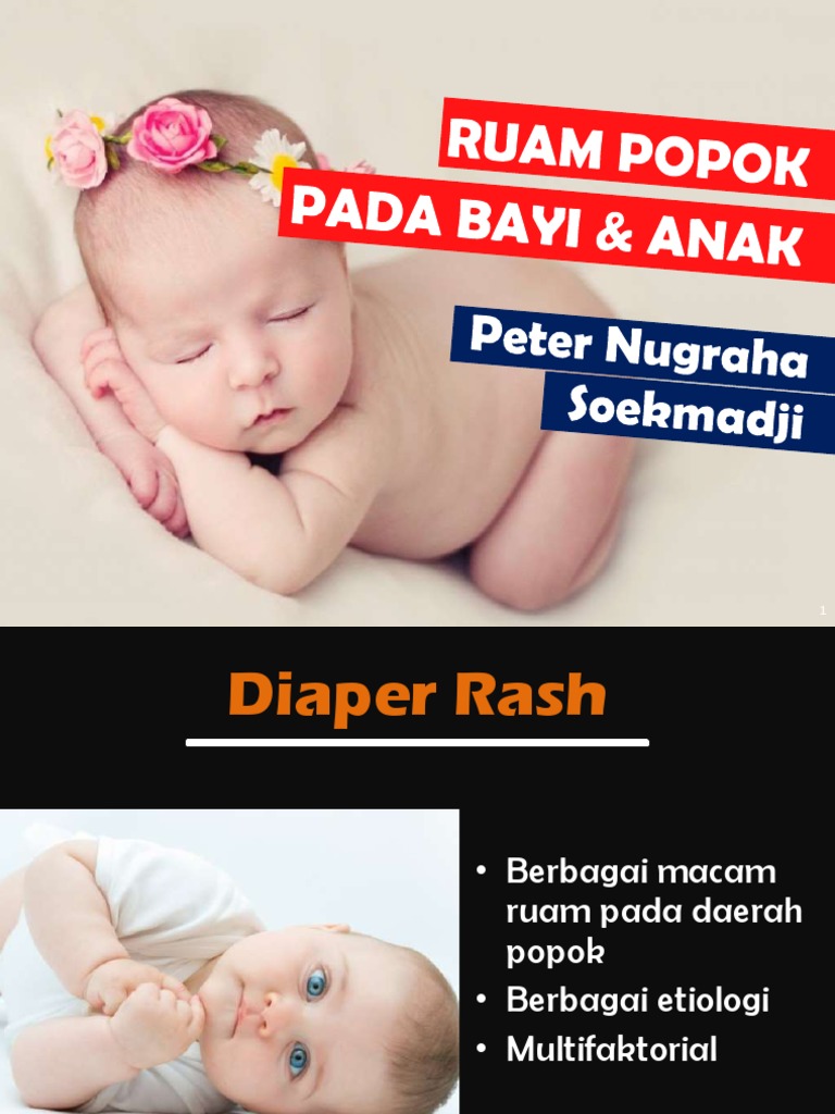 Ruam Popok Pada Bayi & Anak - Peter Nugraha S | PDF