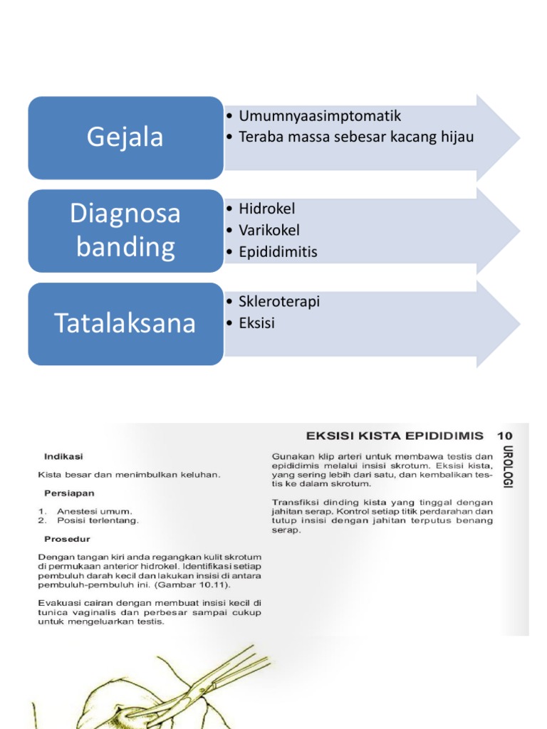 Lo 3 Kista Epididimis | PDF