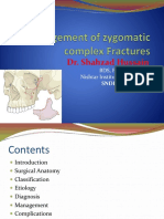 Zygomatic Complex Fractures: Classification, Management and Complications