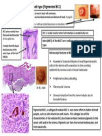 Quick DX Basal Cell Carcinoma Pigmented Type