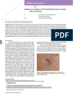 Evaluation of surgical margins according to the histological type of basal