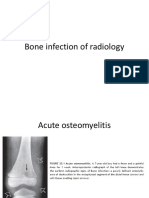 Bone Infection of Radiology