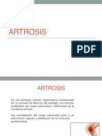 ARTROSIS