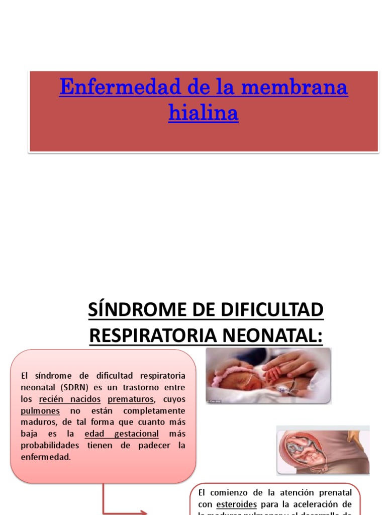 Enfermedad de La Membrana Hialina PDF