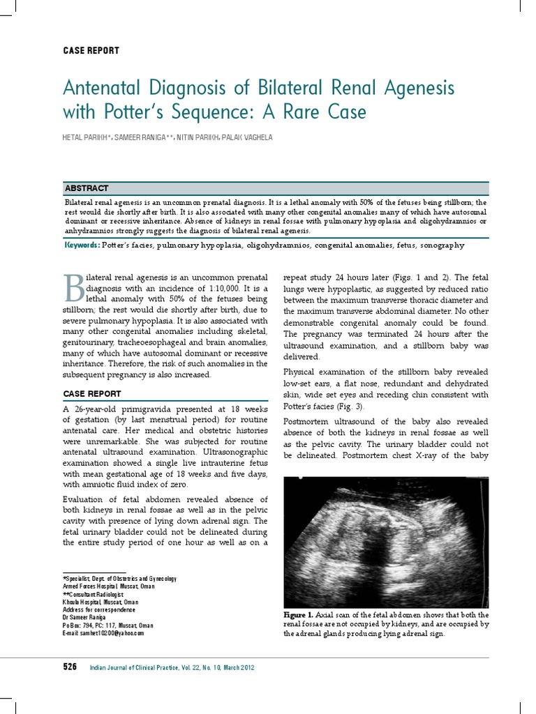 Prenatal Diagnosis of Bilateral Renal Agenesis with Potter's Sequence
