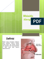 Rhinitis Alergi