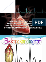 2. ECG normal umkt - Copy - Copy.ppt