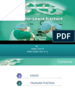 Holstein-Lewis Fracture